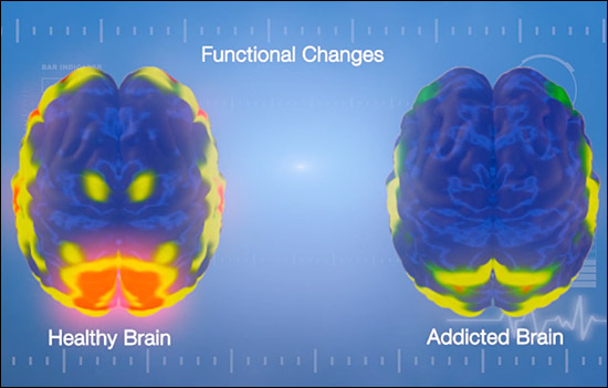 functional brain changes illustration